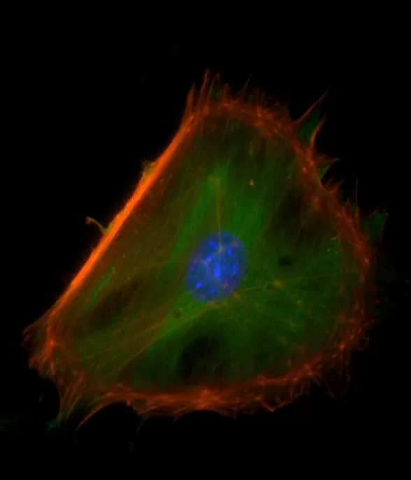 Mouse embryonal fibroblasts: Anti-Cytokeratin (m) detected with DyLight 488 Anti-Mouse IgG, mounted in a 1:1 mixture of VECTASHIELD HardSet Mounting Medium with DAPI and VECTASHIELD HardSet Mounting Medium with TRITC-Phalloidin.