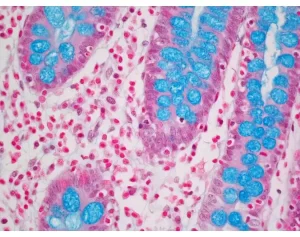 Colon Tissue stained with Alcian Blue (ph 2.5) Stain Kit.