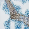 Tumor tissue section showing specific cytoplasmic cell staining (brown, Vector DAB) with Vector Hematoxylin QS (blue) counterstain.