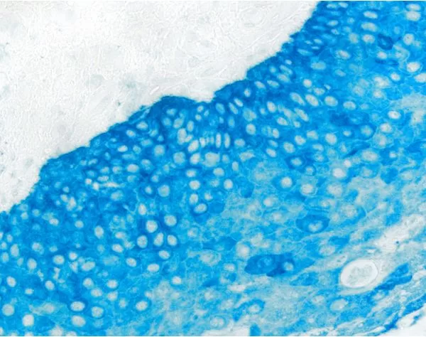Tonsil: Cytokeratin AE1/AE3 (m), ImmPRESS-AP anti-mouse Ig, Vector Blue (blue).