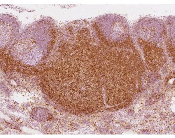 Rhesus macaque formalin/paraffin lymph node: CD4 (1F6), ImmPRESS Anti-Mouse Ig Kit, ImmPACT DAB substrate (brown). Hematoxylin counterstain (blue). Courtesy of Charles Brown, NIH, NIAID, Laboratory of Molecular Microbiology.