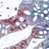 Small Bowel (double label): Ki67 (rp), ImmPRESS Universal Reagent, Vector NovaRED substrate (red); Cytokeratin 8/18 (m), ImmPRESS Universal Reagent, Vector SG substrate (blue/gray).