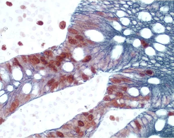 Small Bowel (double label): Ki67 (rp), ImmPRESS Universal Reagent, Vector NovaRED substrate (red); Cytokeratin 8/18 (m), ImmPRESS Universal Reagent, Vector SG substrate (blue/gray).