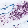 Colon (double label): M2A antigen (m), VECTASTAIN ABC-AP Kit (Universal), Vector Blue (blue). CD20 (m), ImmPRESS Reagent (HRP, Universal), Vector VIP (purple).