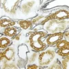 Kidney (double label): CD34 (m), VECTASTAIN Universal Elite ABC Kit, DAB + Ni substrate (gray/black); Cytokeratin 8/18 (m), VECTASTAIN Universal Elite ABC Kit, DAB.