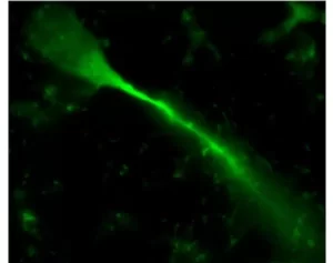 Dendritic spines, 4h post-labeling with NEUROBIOTIN Plus. Image kindly provided by Dr Judith Schweimer, Dept of Pharmacology,University of Oxford, U.K.