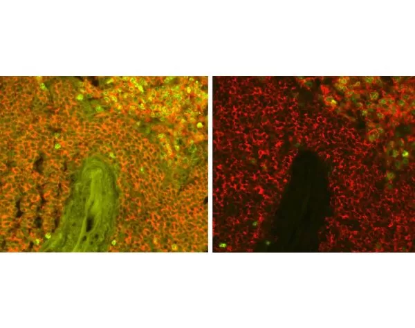 Adjacent sections of Human Pancreas FFPE tissue stained for insulin using fluorescein label (green) and mounted with VECTASHIELD Vibrance Antifade Mounting Medium. Note significant reduction of autofluorescence in treated section (right).