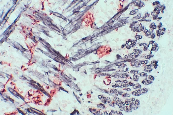 Mouse, Newborn (tongue, double label): Synapsin (m), MOM Peroxidase kit, Vector NovaRED substrate (red); Desmin (m), MOM Peroxidase Kit, DAB+Ni substrate (gray/black). Mouse, Newborn (tongue, double label):  Synapsin (m), MOM Peroxidase kit, Vector NovaRED substrate (red); Desmin (m), MOM Peroxidase Kit, DAB+Ni substrate (gray/black).