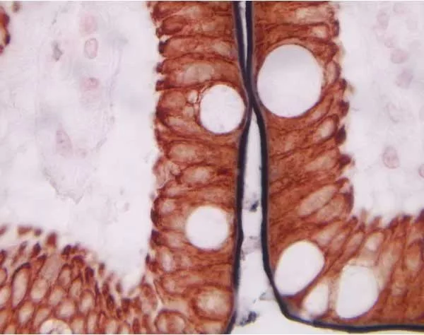 Kathy Mom キット Mouse On Mouse (M.O.M.) Detection Kit, Elite Peroxidase